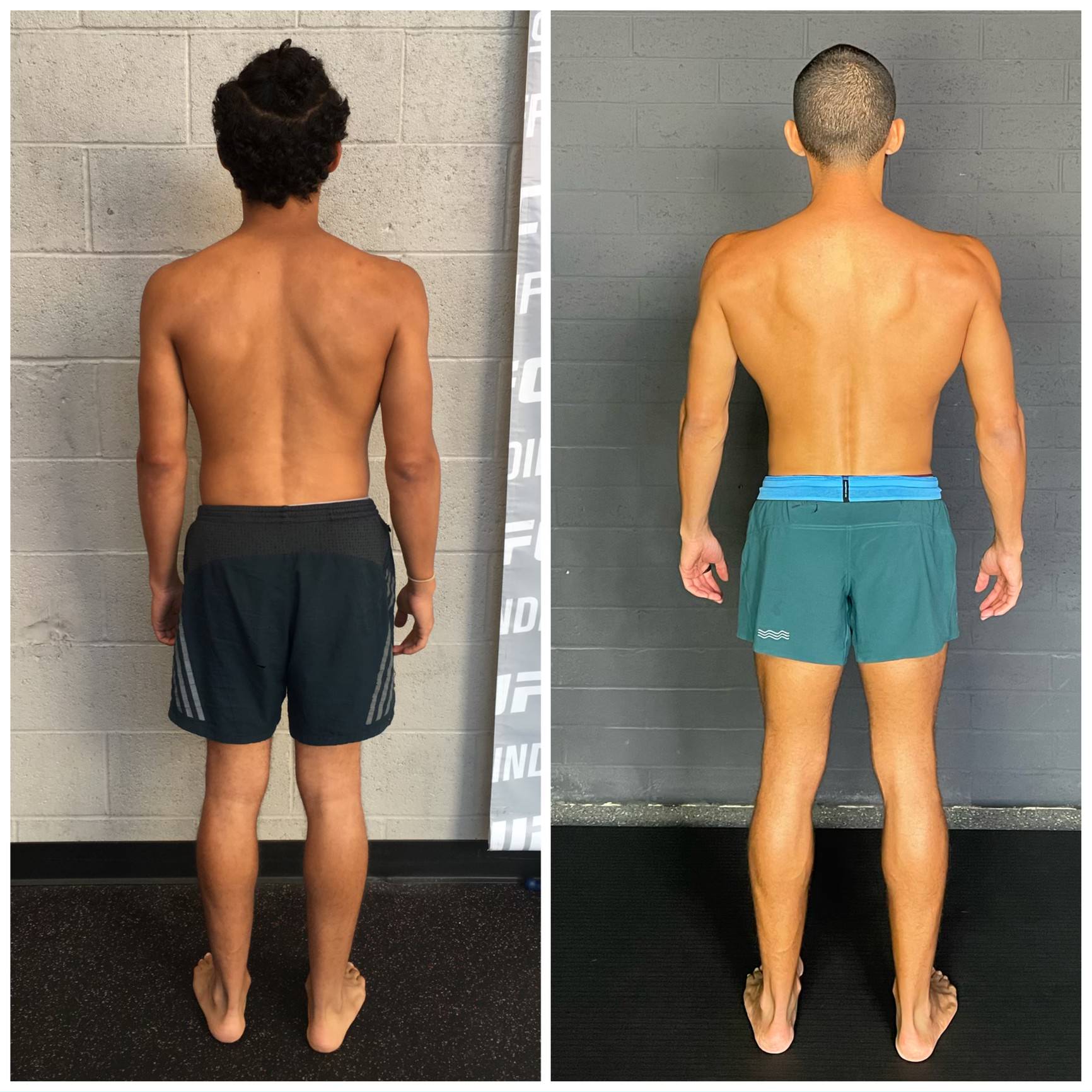 Why Prioritize Posture? — Functional Patterns Sacramento
